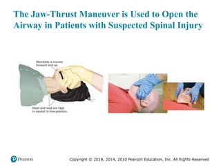 Pec11 chap 10   airway, ventilation, oxygenation