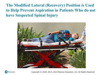 Pec11 chap 10   airway, ventilation, oxygenation