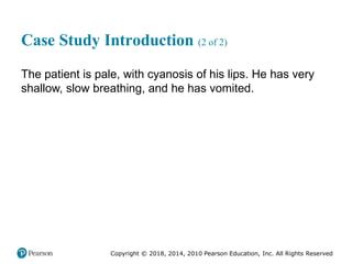 Pec11 chap 10   airway, ventilation, oxygenation