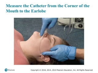 Pec11 chap 10   airway, ventilation, oxygenation