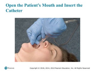 Pec11 chap 10   airway, ventilation, oxygenation