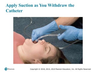 Pec11 chap 10   airway, ventilation, oxygenation