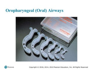 Pec11 chap 10   airway, ventilation, oxygenation