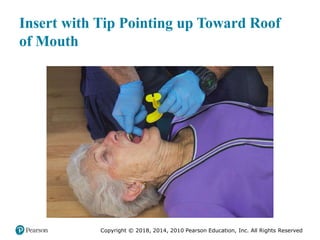 Pec11 chap 10   airway, ventilation, oxygenation