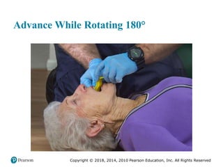 Pec11 chap 10   airway, ventilation, oxygenation