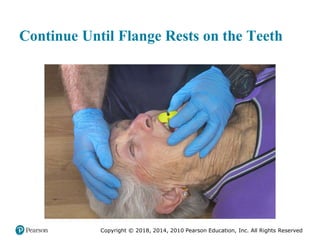 Pec11 chap 10   airway, ventilation, oxygenation