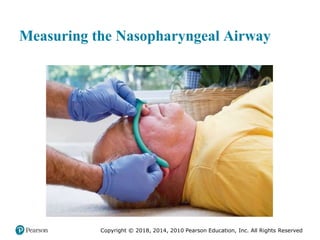 Pec11 chap 10   airway, ventilation, oxygenation