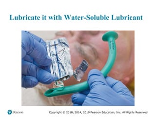 Pec11 chap 10   airway, ventilation, oxygenation