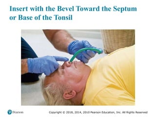 Pec11 chap 10   airway, ventilation, oxygenation