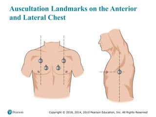 Pec11 chap 10   airway, ventilation, oxygenation