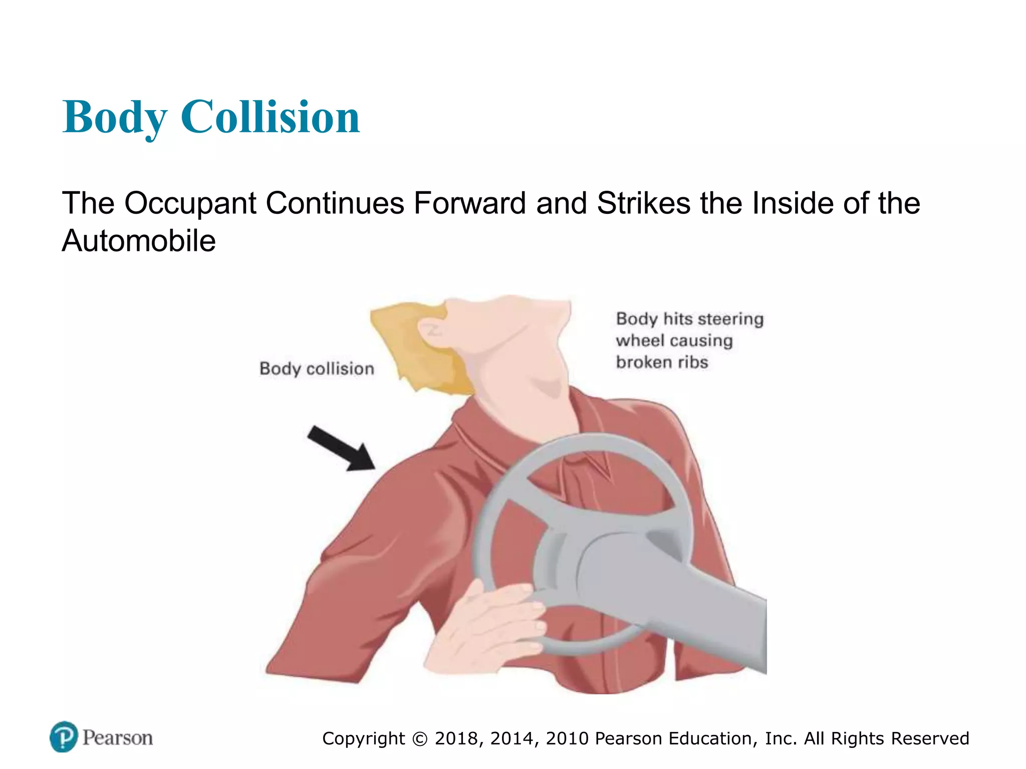 Pec11 chap 27 trauma overview