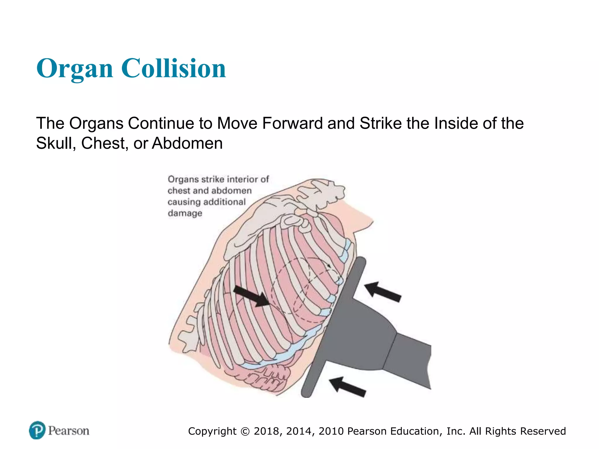 Pec11 chap 27 trauma overview