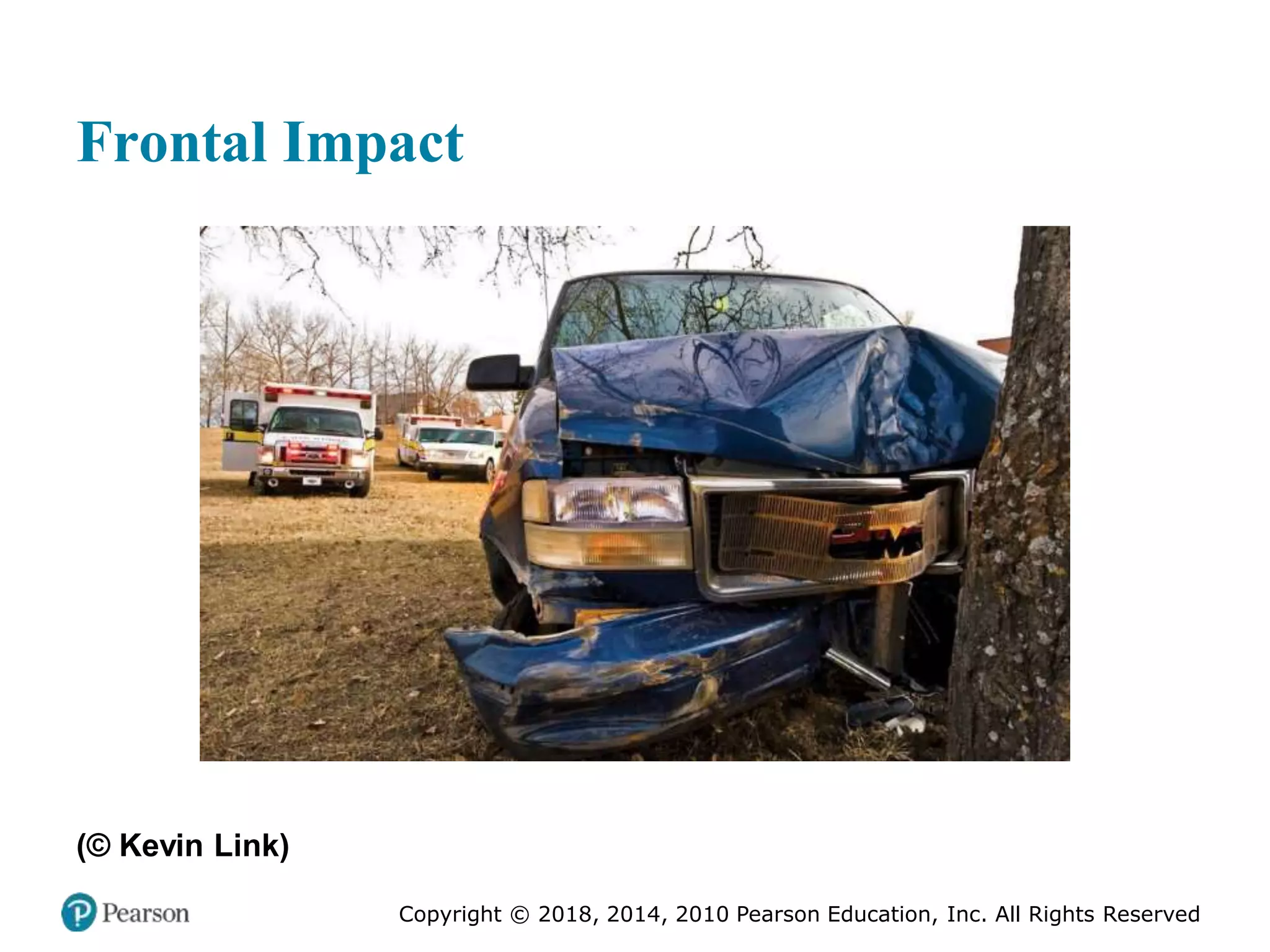 Pec11 chap 27 trauma overview