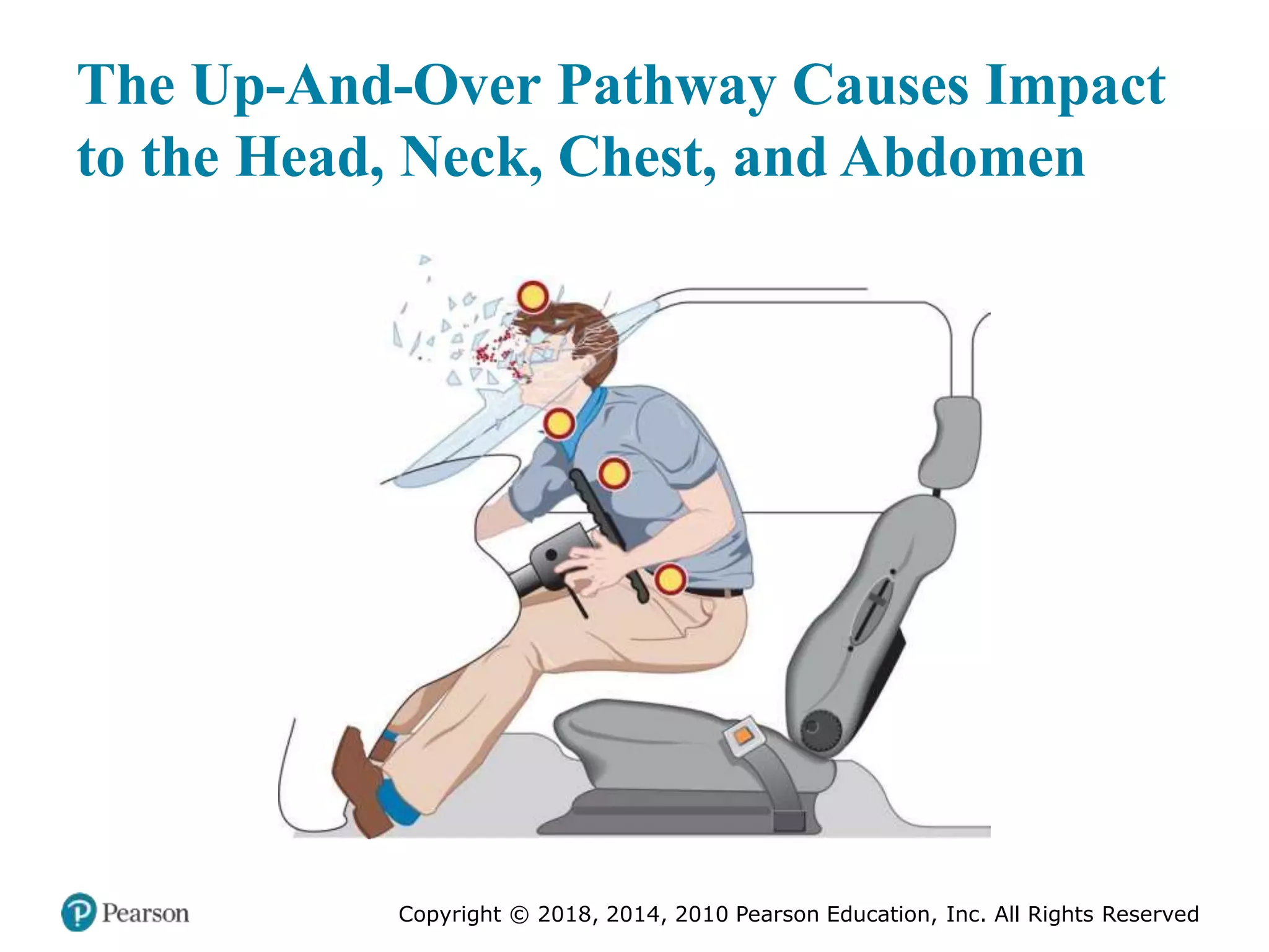 Pec11 chap 27 trauma overview
