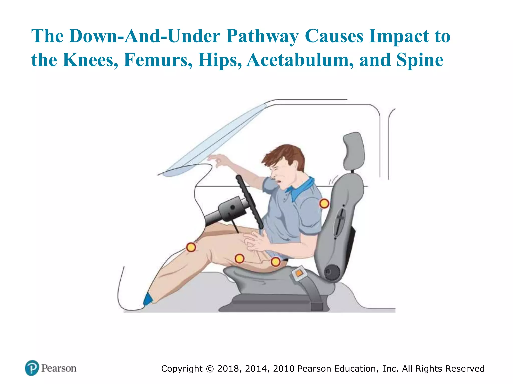 Pec11 chap 27 trauma overview