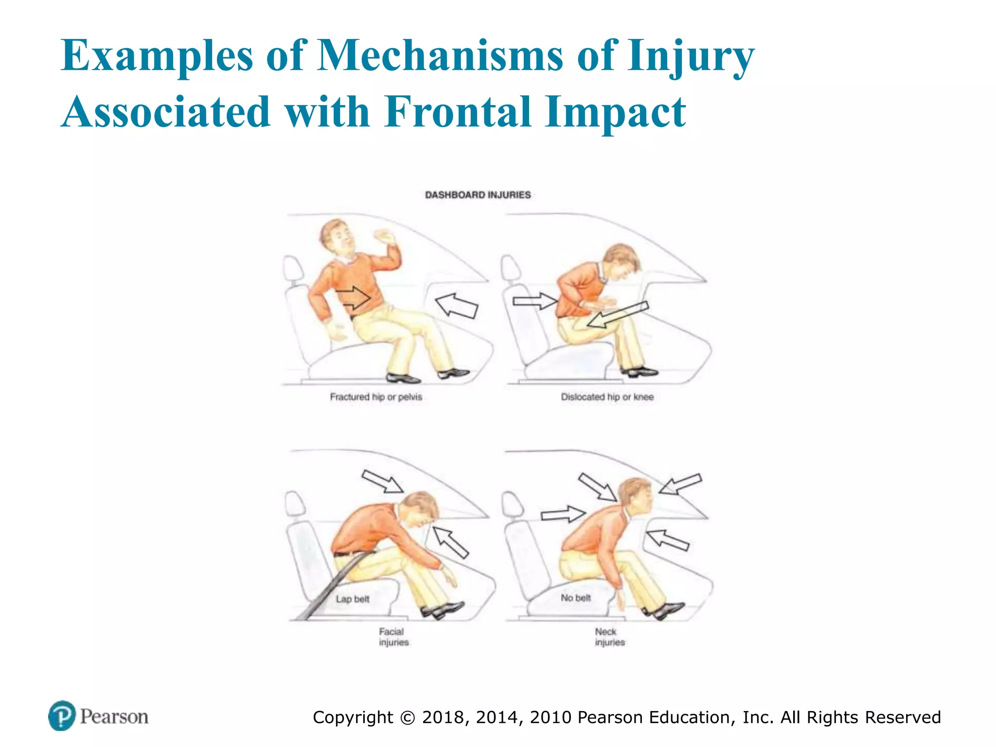 Pec11 chap 27 trauma overview