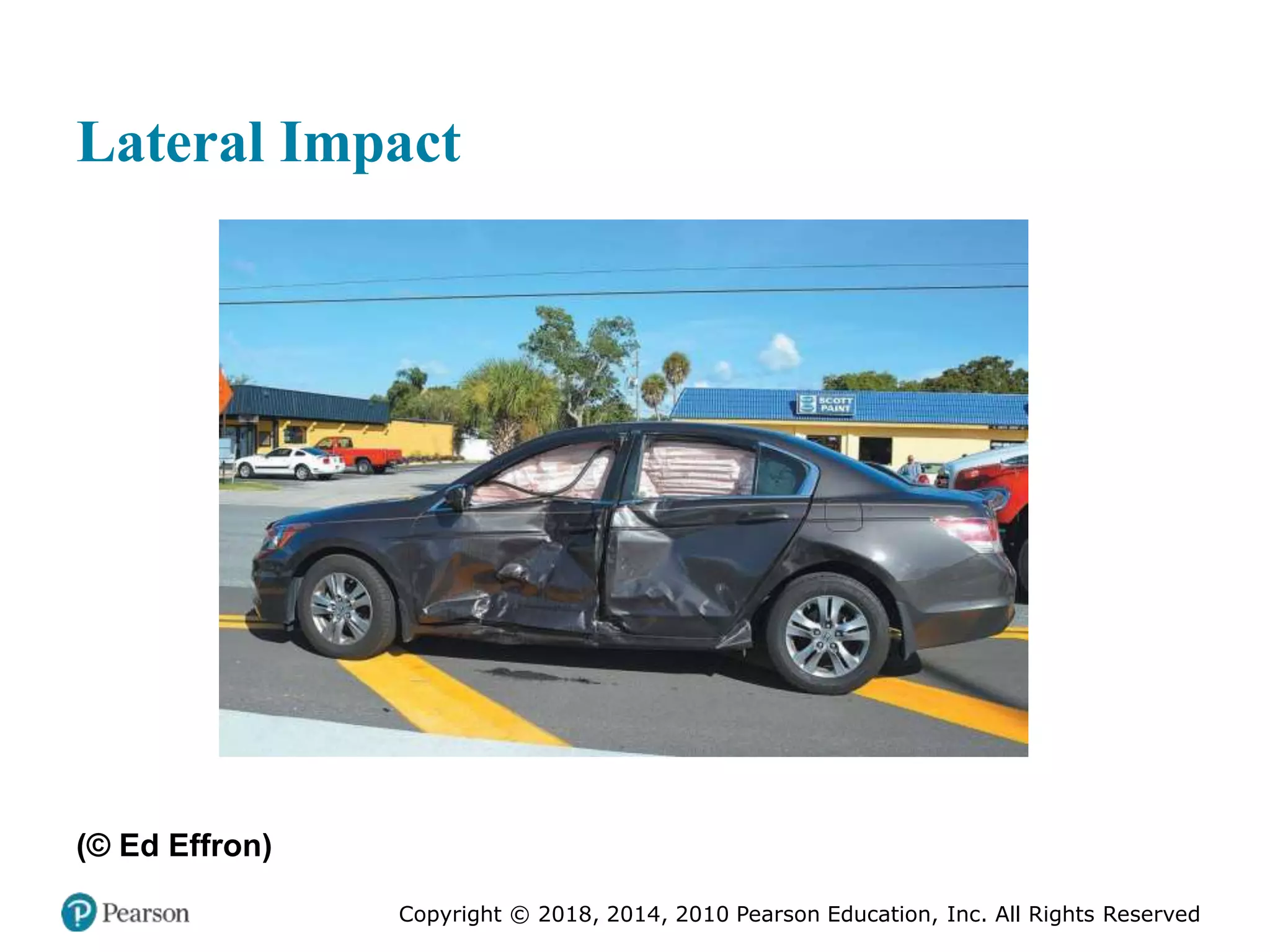 Pec11 chap 27 trauma overview