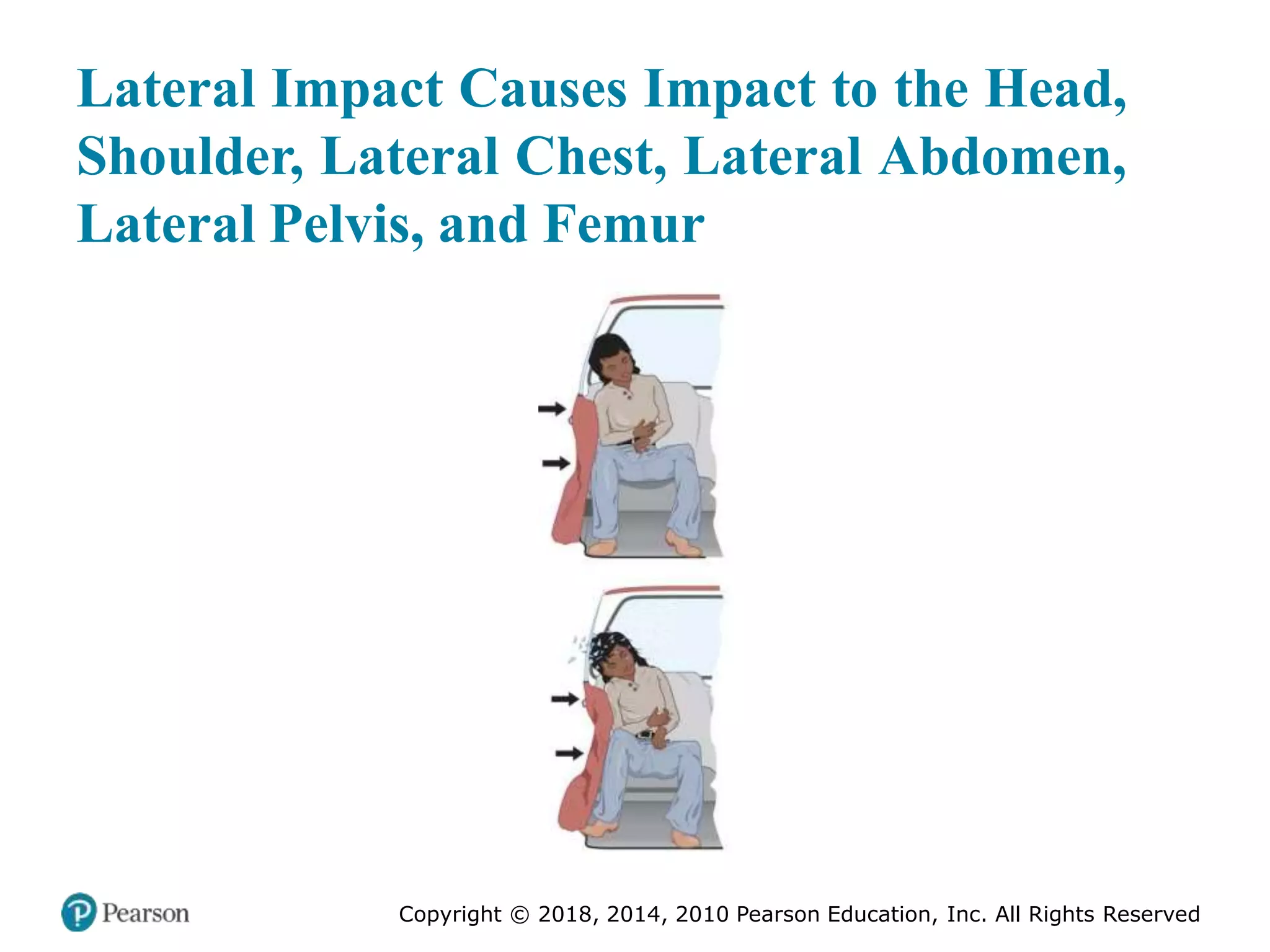Pec11 chap 27 trauma overview