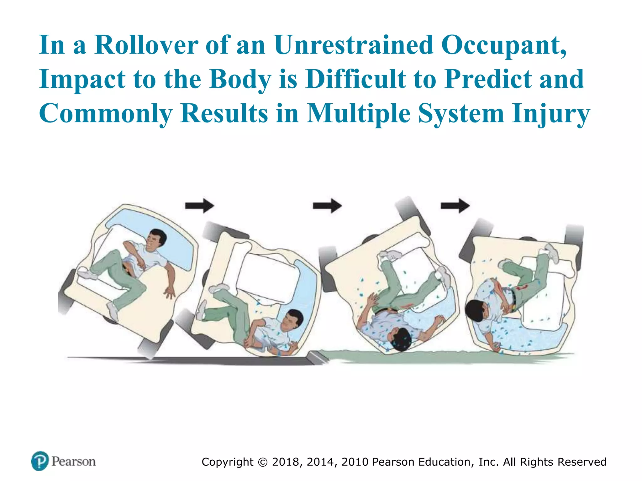 Pec11 chap 27 trauma overview