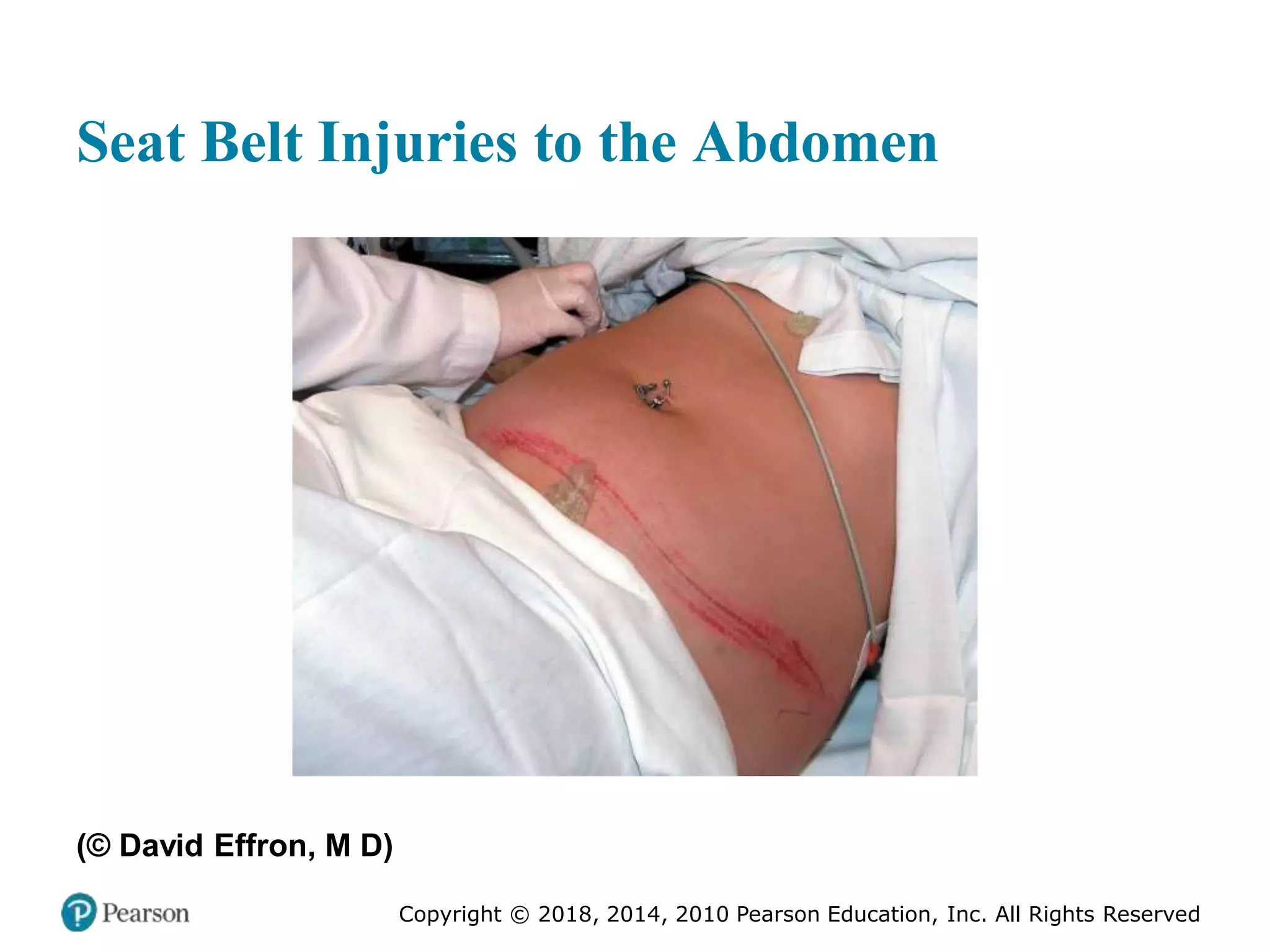 Pec11 chap 27 trauma overview