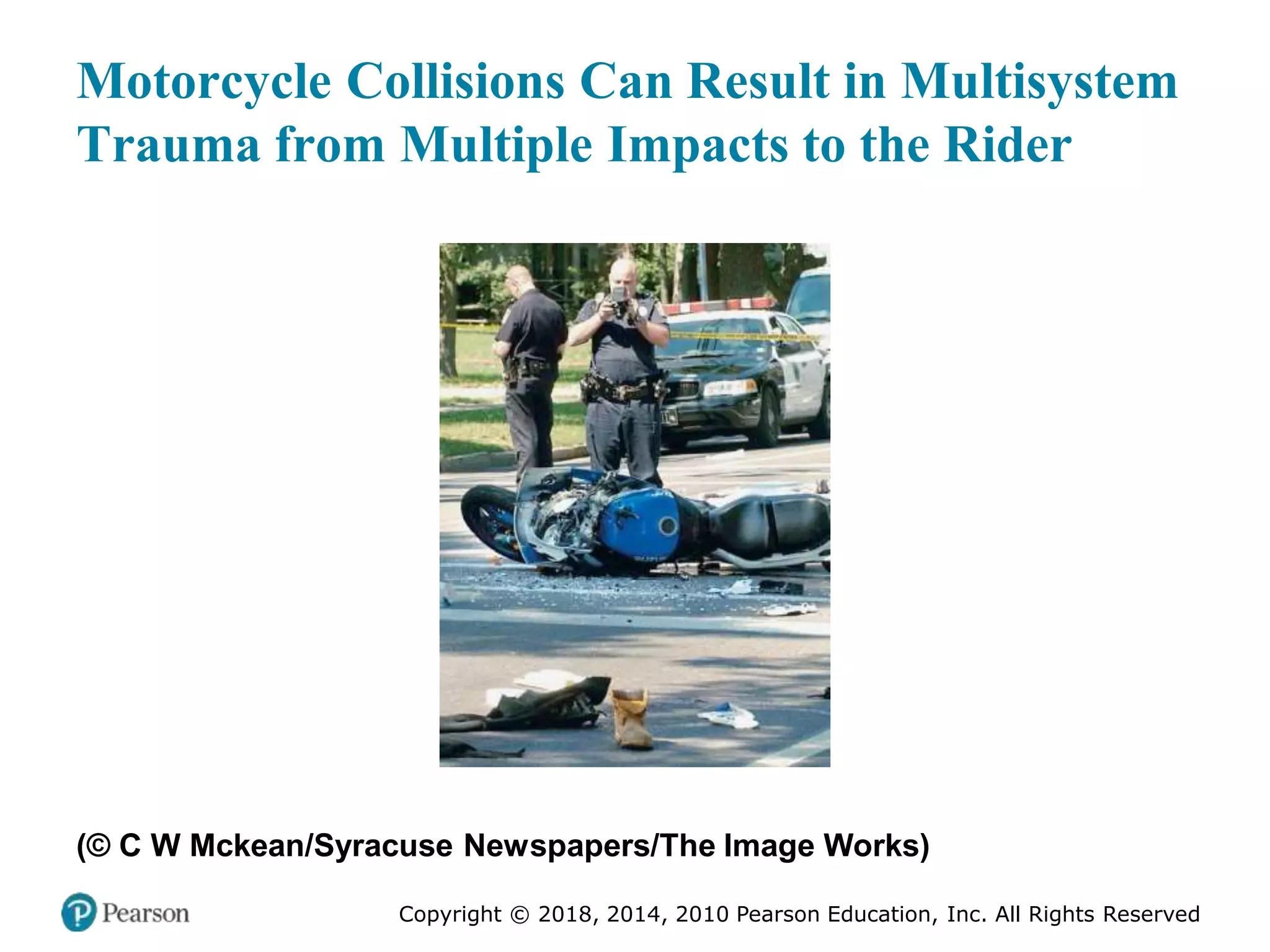 Pec11 chap 27 trauma overview