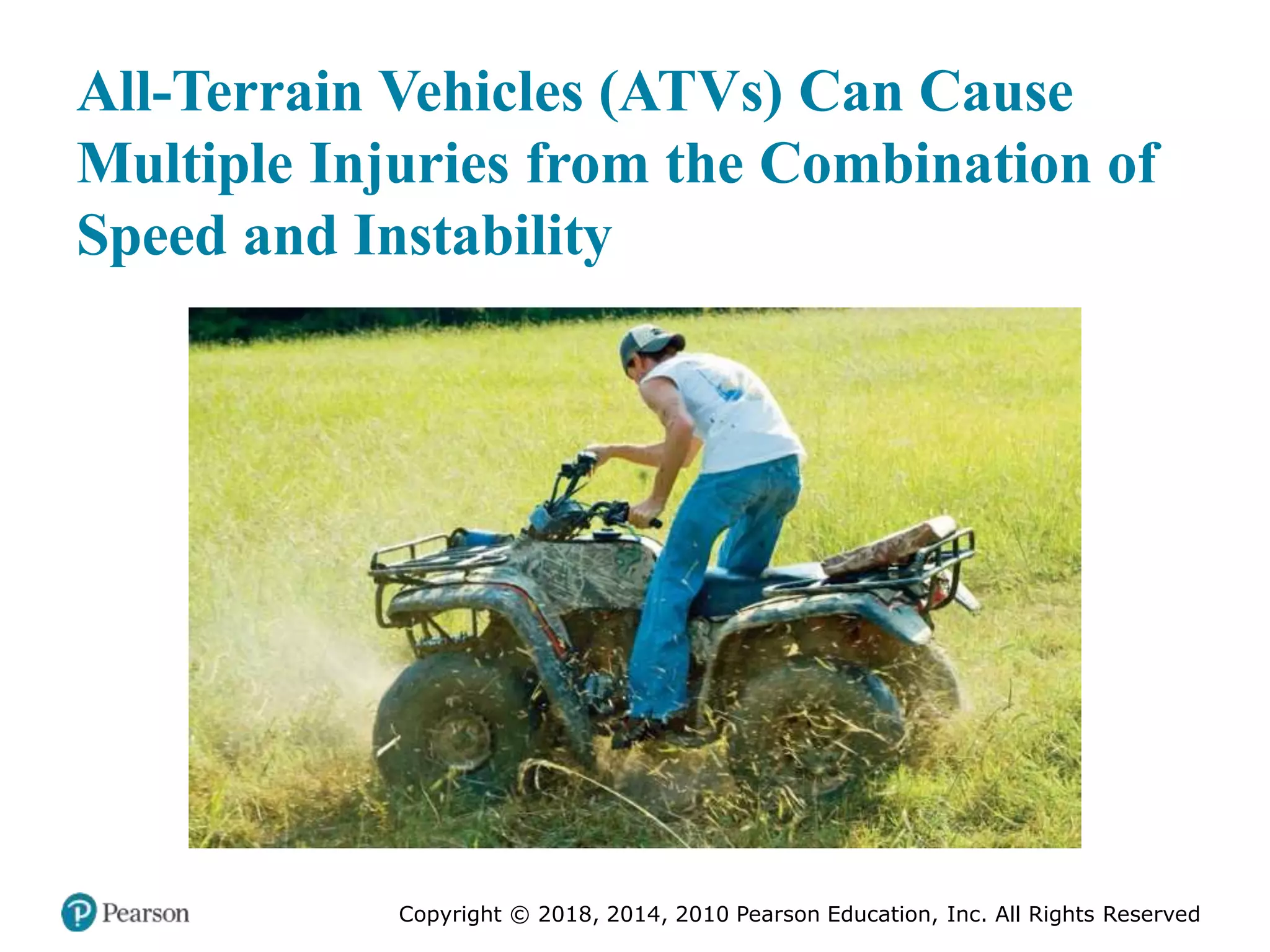 Pec11 chap 27 trauma overview