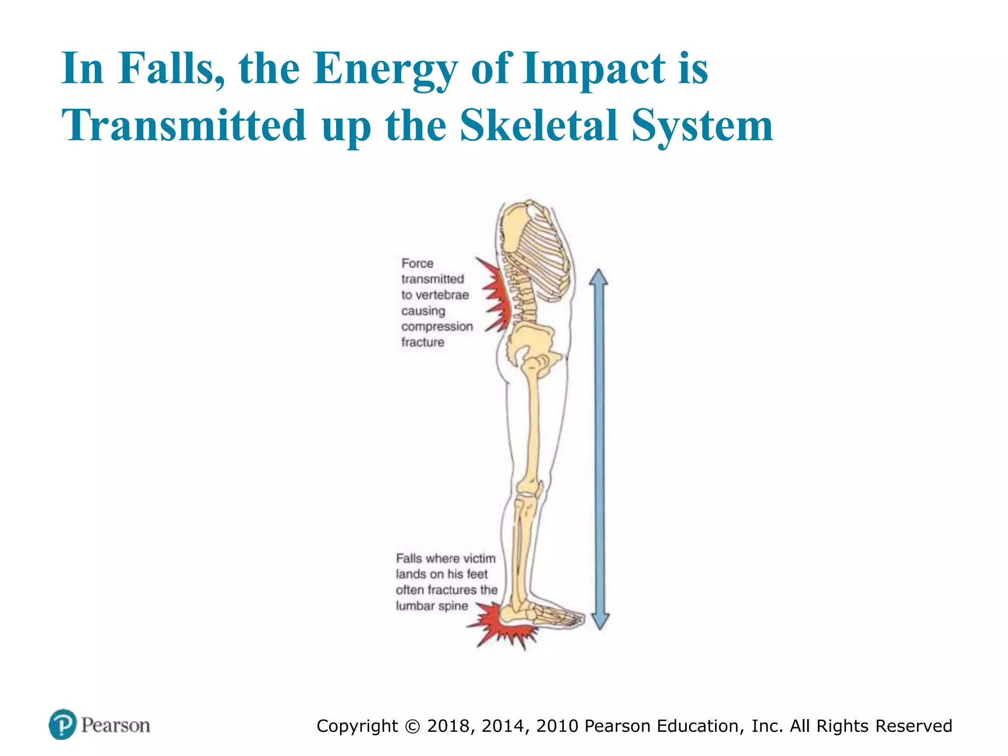 Pec11 chap 27 trauma overview
