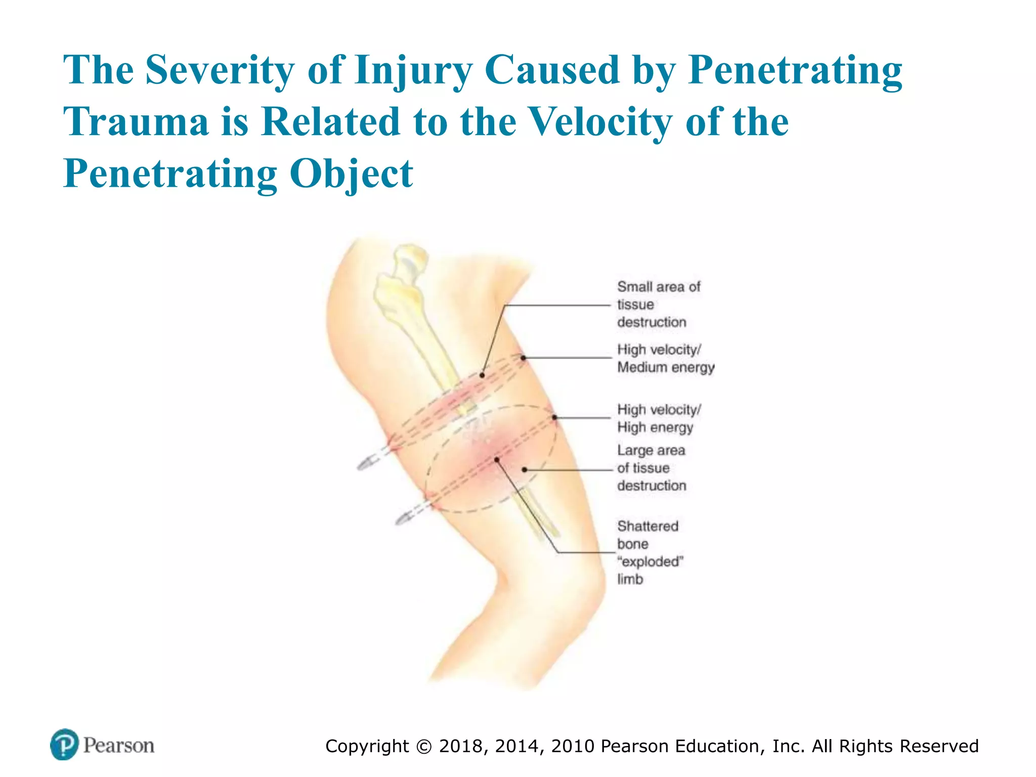 Pec11 chap 27 trauma overview