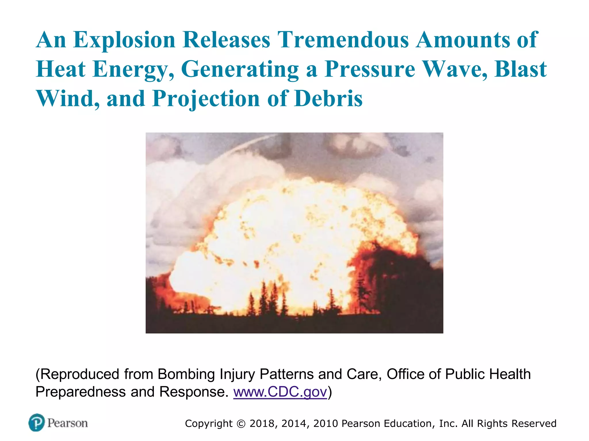 Pec11 chap 27 trauma overview