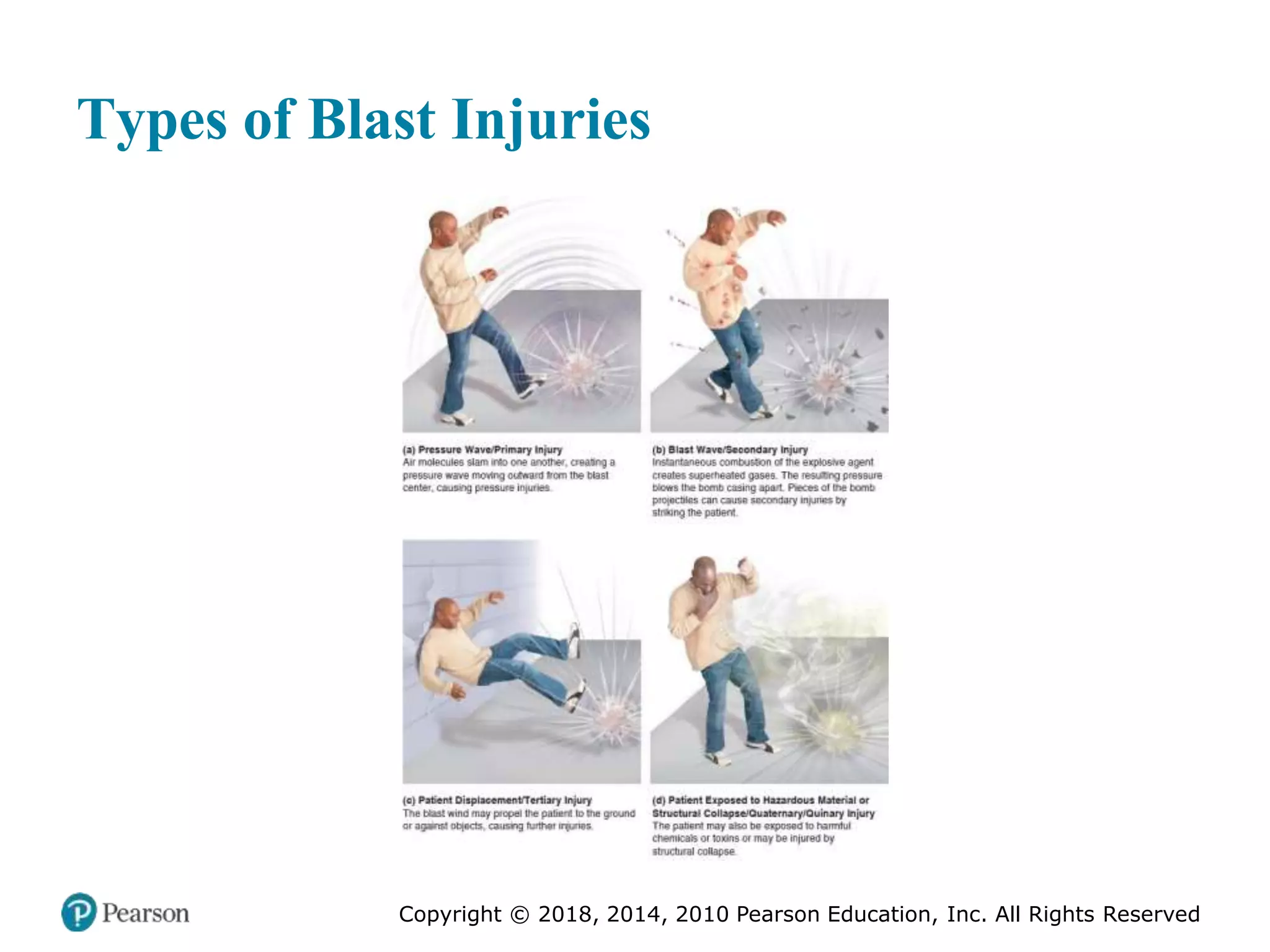 Pec11 chap 27 trauma overview