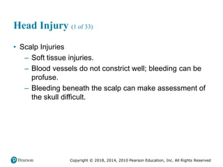 Pec11 chap 31 head trauma