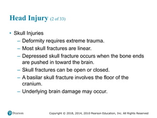 Pec11 chap 31 head trauma