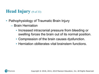 Pec11 chap 31 head trauma