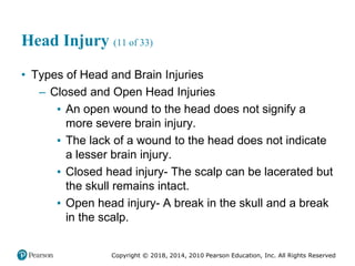 Pec11 chap 31 head trauma