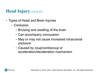 Pec11 chap 31 head trauma