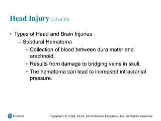 Pec11 chap 31 head trauma
