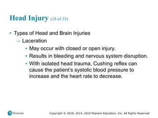 Pec11 chap 31 head trauma