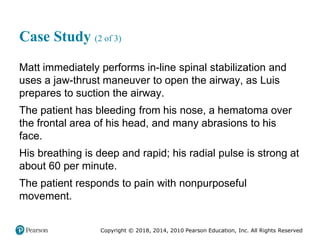 Pec11 chap 31 head trauma
