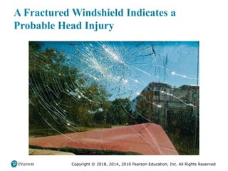 Pec11 chap 31 head trauma