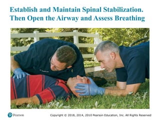 Pec11 chap 31 head trauma