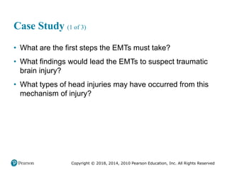 Pec11 chap 31 head trauma