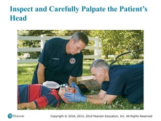 Pec11 chap 31 head trauma