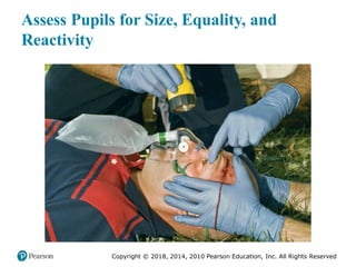 Pec11 chap 31 head trauma