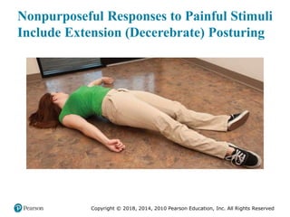 Pec11 chap 31 head trauma