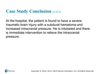 Pec11 chap 31 head trauma