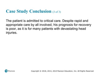 Pec11 chap 31 head trauma