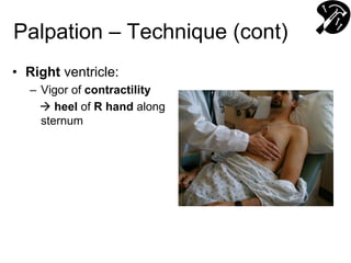 Palpation – Technique (cont)
• Right ventricle:
– Vigor of contractility
 heel of R hand along
sternum
 