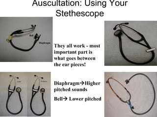 Auscultation: Using Your
Stethescope
They all work - most
important part is
what goes between
the ear pieces!
DiaphragmHigher
pitched sounds
Bell Lower pitched
 