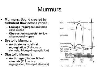 Murmurs
• Murmurs: Sound created by
turbulent flow across valves:
– Leakage (regurgitation) when
valve closed
– Obstruction (stenosis) to flow
when normally open
• Systolic Murmurs:
– Aortic stenosis, Mitral
regurgitation (Pulmonary
stenosis, Tricuspid regurgitation)
• Diastolic Murmurs:
– Aortic regurgitation, Mitral
stenosis (Pulmonary
regurgitation, Tricuspid stenosis)
 