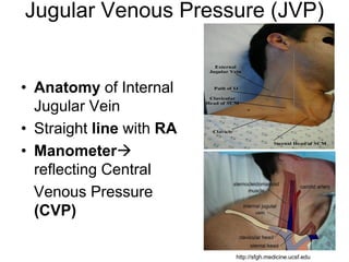 Jugular Venous Pressure (JVP)
• Anatomy of Internal
Jugular Vein
• Straight line with RA
• Manometer
reflecting Central
Venous Pressure
(CVP)
http://sfgh.medicine.ucsf.edu
 